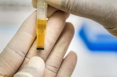 Teknologi Microneedle: Mengangkat-Tabir Antarmuka Teknik Biomedis